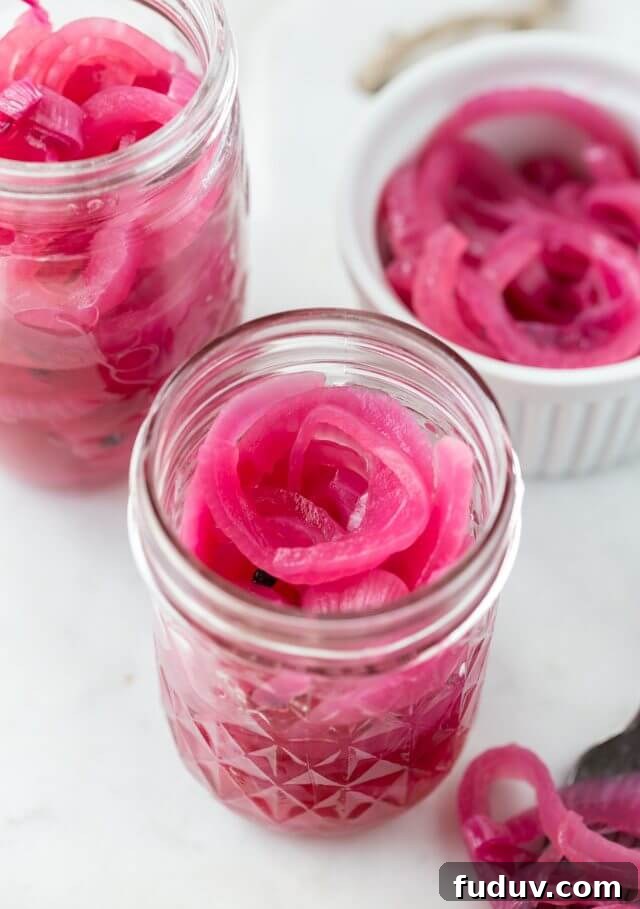 Pickled Red Onions