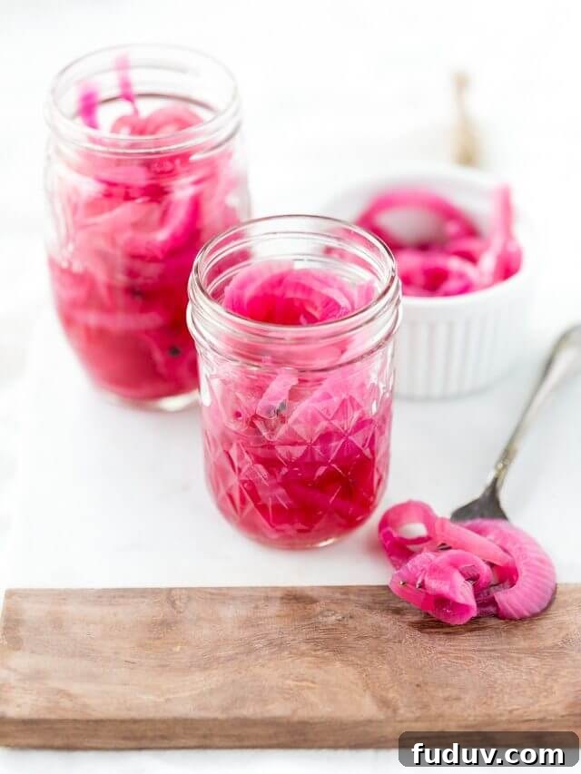 Pickled Red Onions
